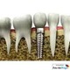 Imagine anunţ Dentist Drumul Taberei