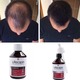 Imagine anunţ Set L-Recapin 1+1 prevenirea căderii părului şi regenerare